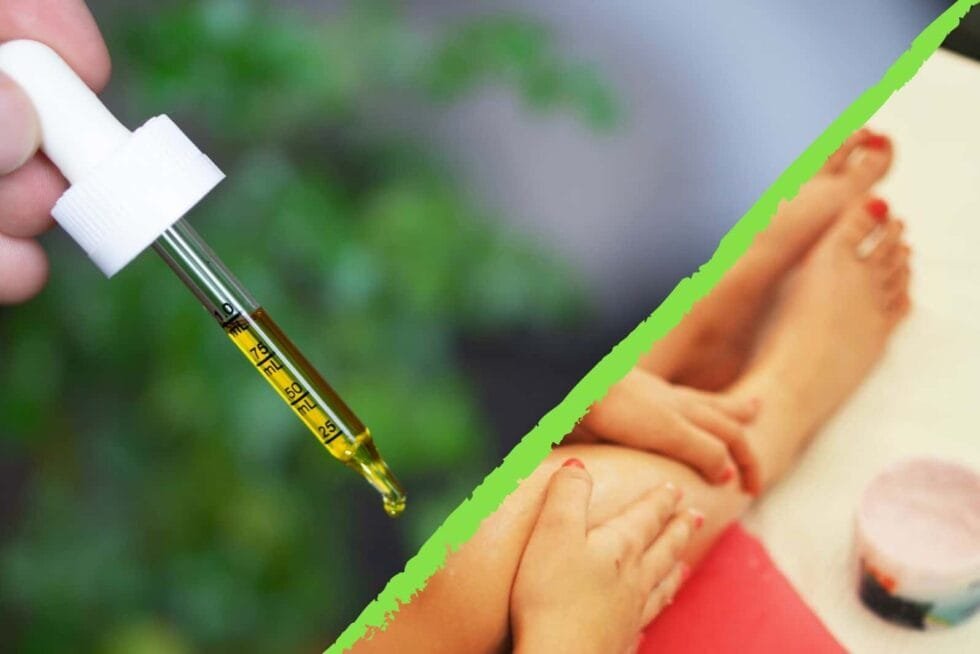 CBD i psorijaza